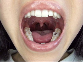 300人のおくち 3 サンプル動画サムネイル